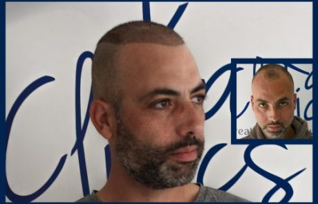 הדמיית שיער